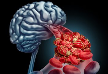 Ұйқысыз өткізген түннің аса қауіпті салдары белгілі болды