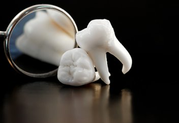 Түсіп қалған тістің орнына тіс өсірудің тәсілі табылды