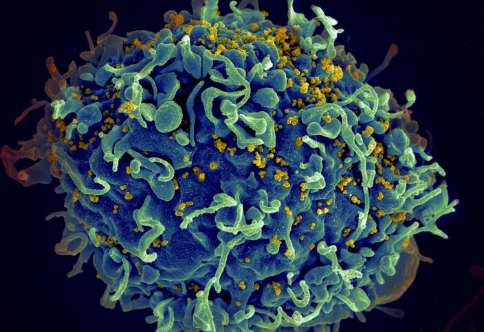 Второй пациент в истории полностью излечился от ВИЧ