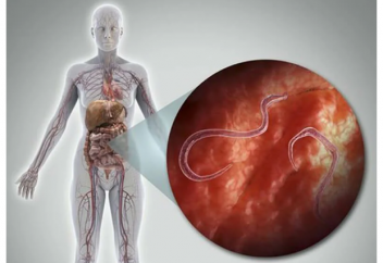 Как можно определить наличие паразитов в организме