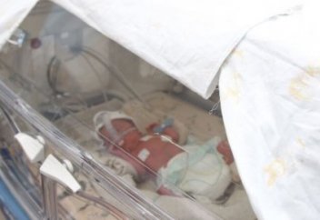 Уникальную операцию на сердце четырехдневному ребенку провели казахстанские врачи