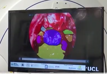 Ғалымдар сүйек имплантын ойлап тапты