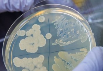 Түрік ғалымдары маңызды жаңалық ашуға қол жеткізді