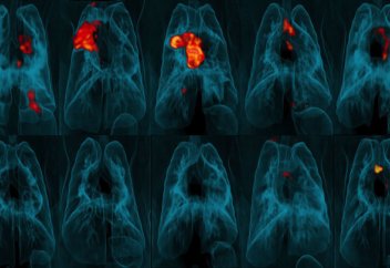 Опасная болезнь может выйти из-под контроля из-за COVID-19