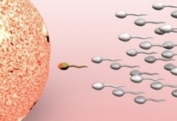 Жүктілікті болдырмау үшін хирургиялық бедеулiкті жасатуға (стерилизацияға) шариғат не дейді?