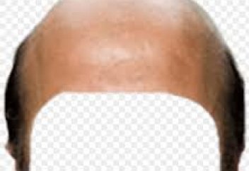 Кәріс ғалымдары тазды емдеу тәсілін тапты