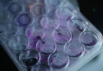 Қатерлі ісік тудыруға қабілетті вирустар аталды