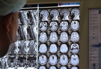 "Поймать нерв". Как в Президентской клинике удаляют опухоли головного мозга