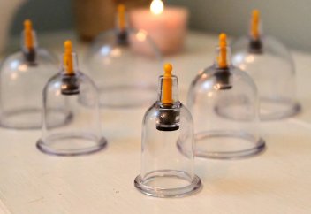 Хижамадан кейінгі қан «нәжіс» пе? Хижамадан кейін «ғұсыл» құйыну шарт па?