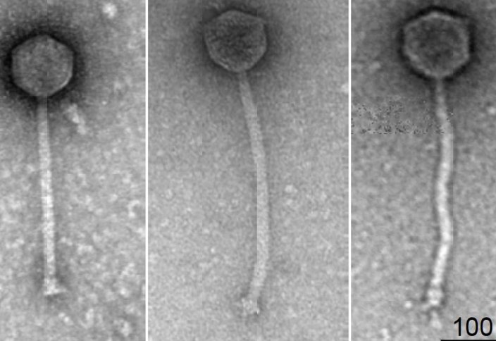 ГМО-вирус впервые убил устойчивые к лекарствам бактерии и вылечил пациента