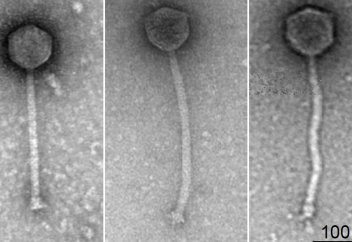 ГМО-вирус впервые убил устойчивые к лекарствам бактерии и вылечил пациента