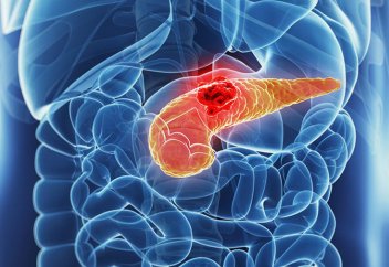 Ұйқы безінің обырын жоятын дәрі жасалды