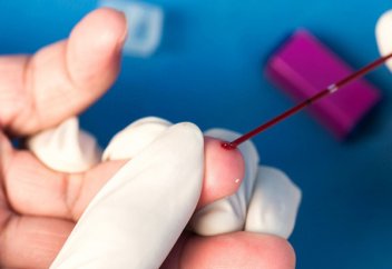 Отау құрардан бұрын толық медициналық тексерістен өту керек: Денсаулық сақтау министрлігі заңға жаңа өзгеріс енгізбек