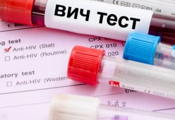 Бесплатно сдать тест на ВИЧ могут казахстанцы