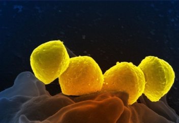 Скарлатина эволюционировала: ученые предупреждают о возвращении патогена (El Confidencial, Испания)