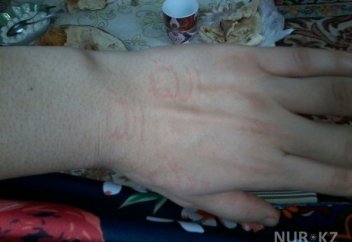 Ел жаңалықтары: ОҚО тұрғынының денесінде ғайыптан арабша жазулар пайда болады (фото)