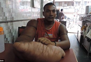 Үндістандық жігітті туыстары қолындағы кемістігі үшін ібіліске теңеп, үйіден қуған (фото)