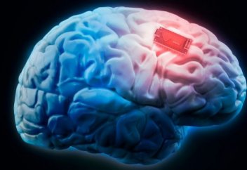 Илон Маск миға қондырылатын чиптің пайдасын айтты