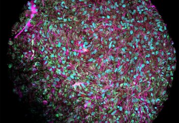 Ғалымдар көптеген органоидтен тұратын «биокомпьютер» құрастырады