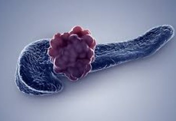 Әлемде алғаш рет ұйқы безінің қатерлі ісігінің емі табылды  (алғаш рет науқас жазылды)