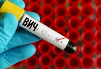 Елімізде қанша адам ВИЧ-инфекциясын жұқтырған?