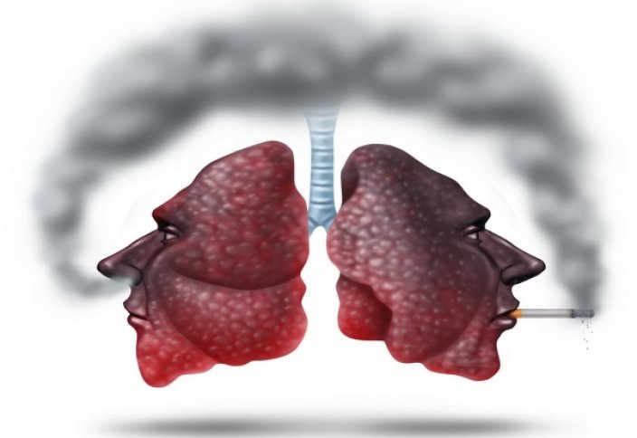 Сигаретный дым замедляет восстановление легких