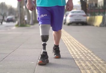 Бір аяғы протез болған мұсылман мәсіні қалай киеді? Дәрет алғанда аяқты жуа ма?