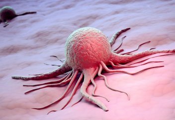 Әлемде обырмен ауыратын науқастар саны көп ел белгілі болды