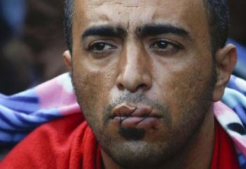 Ауыздарын тігетіндей қадамға не итермеледі?