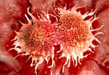 Как связаны раковые клетки и сахар?