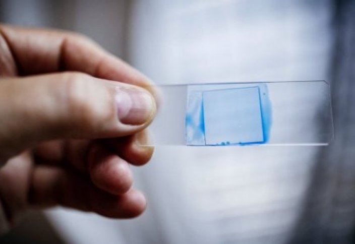 По миру распространяется смертельный "супергрибок"