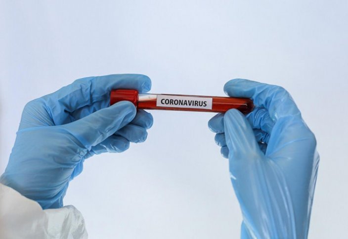 Коронавирус провоцирует появление у казахстанцев новых болезней