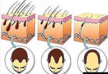 Таз болудың себебі анықталды