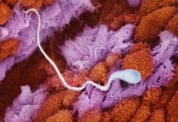 Шәует­тің бір там­шы­сы