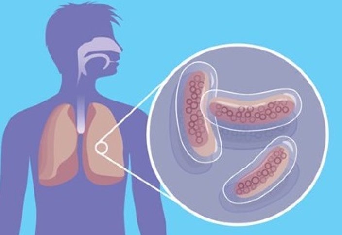 Туберкулезбен күресудің өте тиімді әдісі табылды