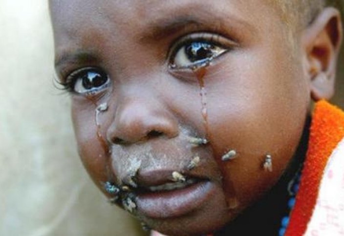 34 тысячи детей в Нигерии находятся на грани голодной смерти