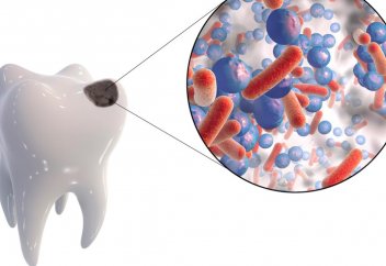 Тістегі бактерия миға қауіп төндіреді – зерттеу