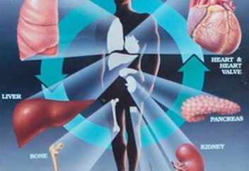 Елімізде трансплантация тегін жасалатын болады