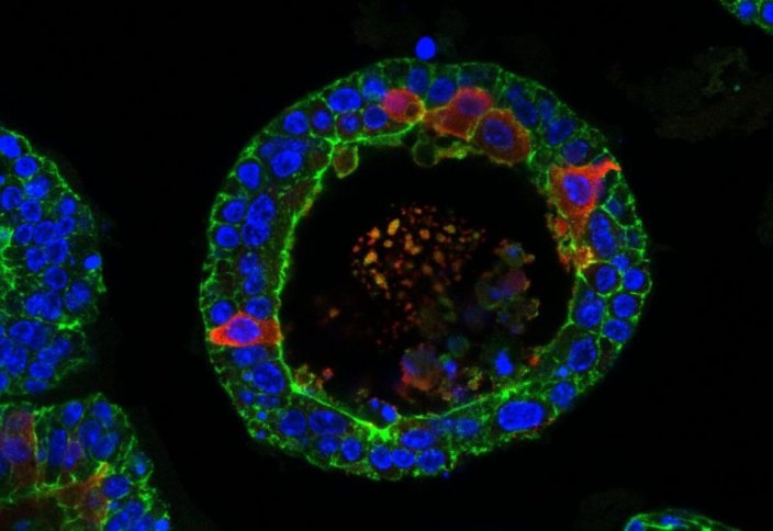 Разные: Биологи вырастили слезные железы человека в лаборатории и заставили их плакать