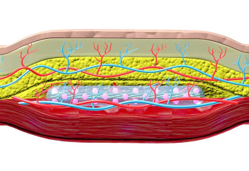 Инсулин бөлетін, тері астына жасырылатын имплант сусамыр дертінен айықтырды