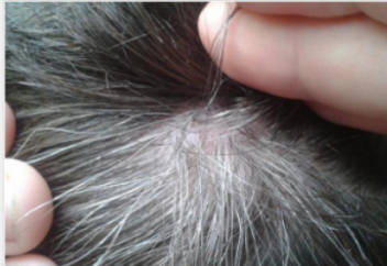 Шаш неге ағарады?