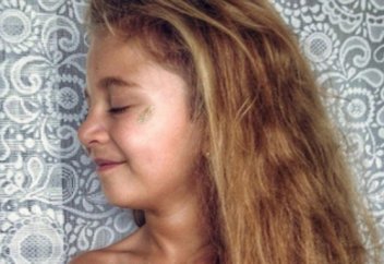 Жүрегі сыртында орналасқан қыз бала дәрігерлерді таңғалдыруда