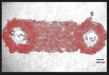 Жүректің жұрнағы 3D-принтерде басылып шықты