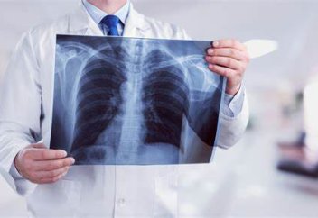 Рентген пленкасын өңдеу қондырғыларының нарығы 3034 жылға таман 2,5 млрд долларға жетеді