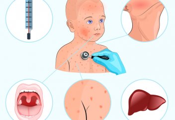 Детские болезни, которые могут убить взрослого 