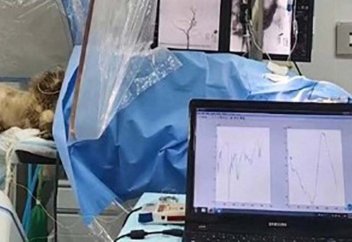 Нейротрансплантациядағы төңкеріс: чип миға отасыз енгізілді