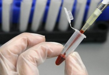 Елдегі маңызды жаңалықтар: Қазақстанда АИТВ-ны жұқтыру мерзімі тың әдіспен анықталатын болады