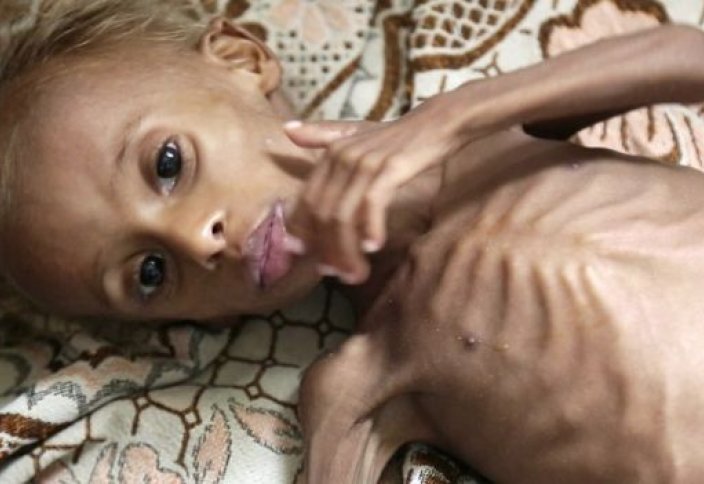 BBC показал фильм о голоде в Йемене