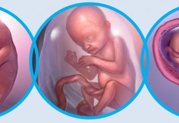 «Жүкті әйелдің бір аяғы жерде, бір аяғы...»