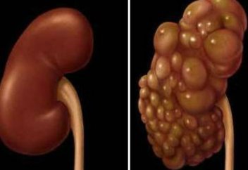 Семіздік індетімен күрес: дұрыс тамақтану комитеті құрылды